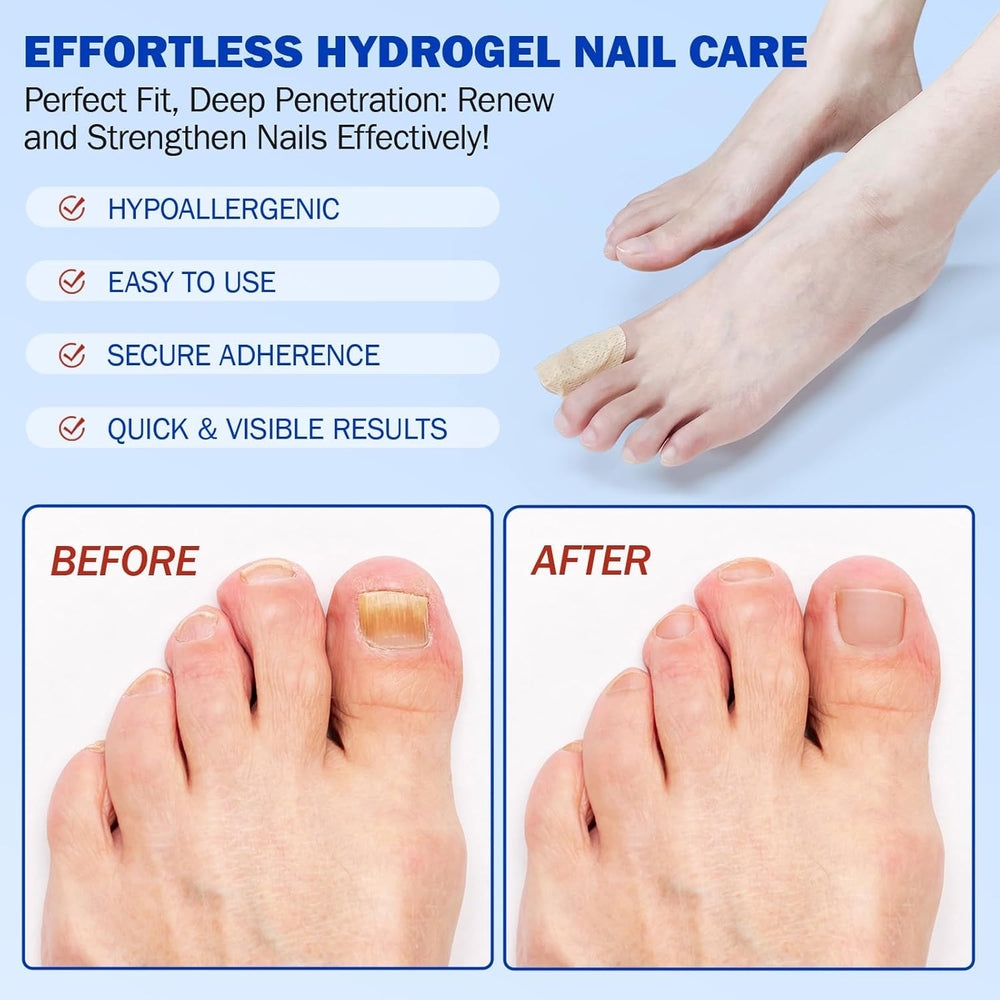 FANSHI patch applied to toenail demonstrating secure overnight fit