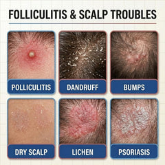 FLYLEAF being applied to scalp bumps to show targeted application and quick relief benefit