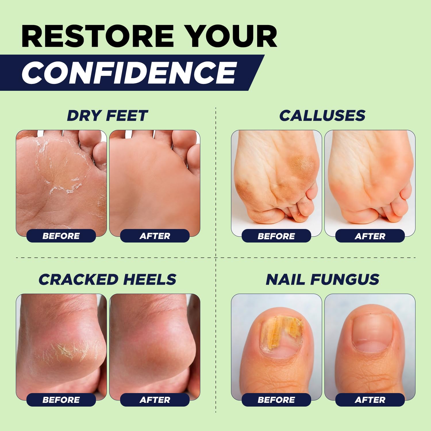 FOOT CURE tea tree oil and botanicals detail highlighting natural scent
