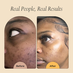 Glo Melanin jar open top view revealing lightweight cream and easy application