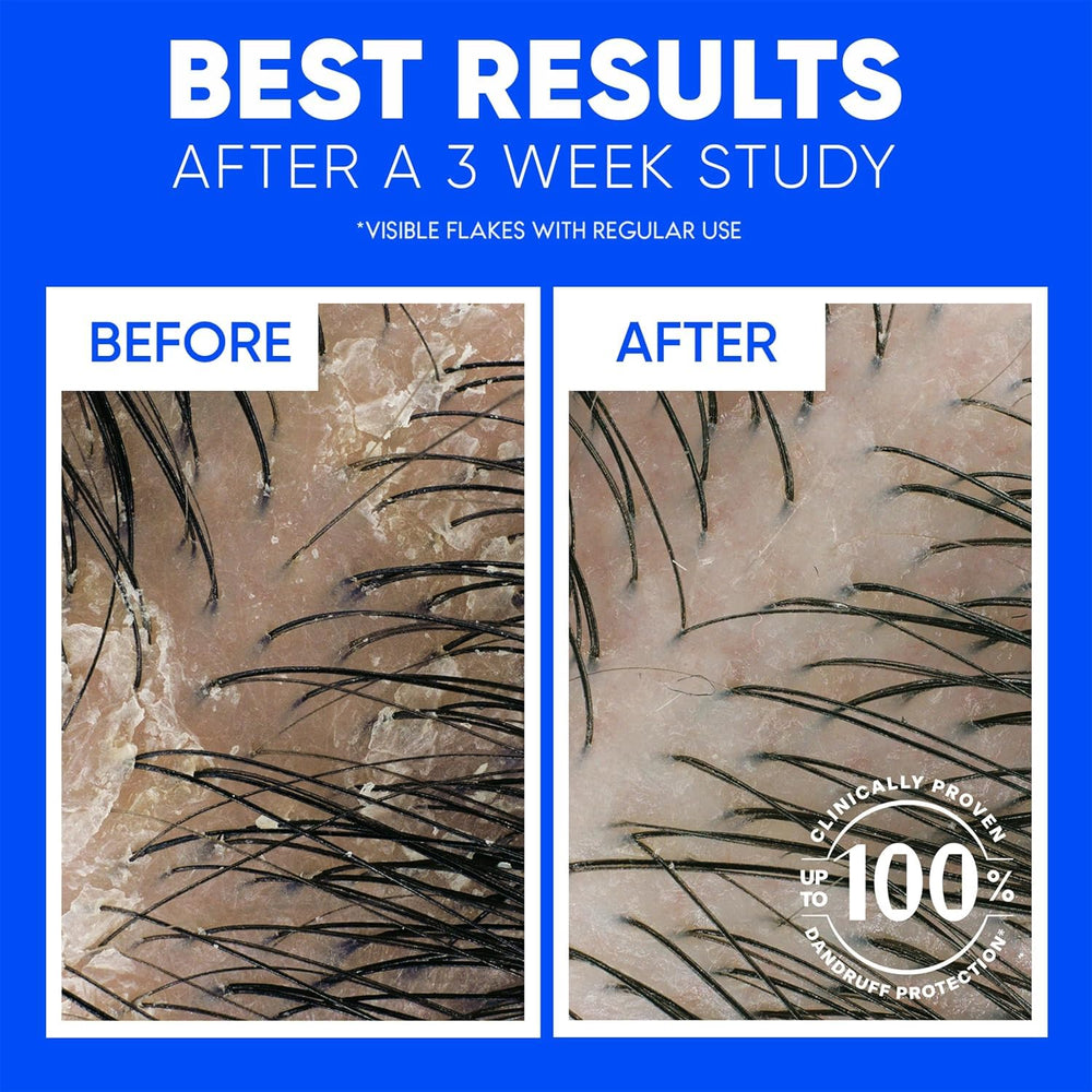 Head & Shoulders paired with conditioner to restore scalp protection