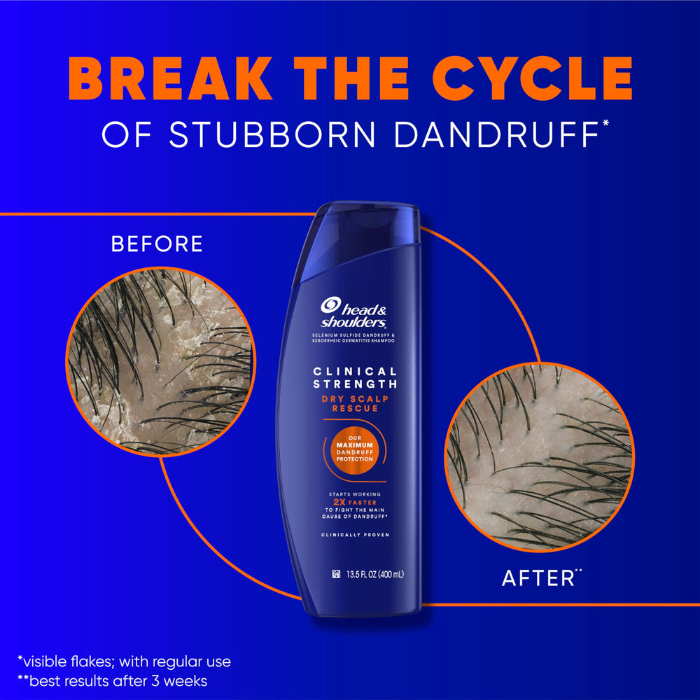 Person using Head & Shoulders shampoo in shower showing easy application