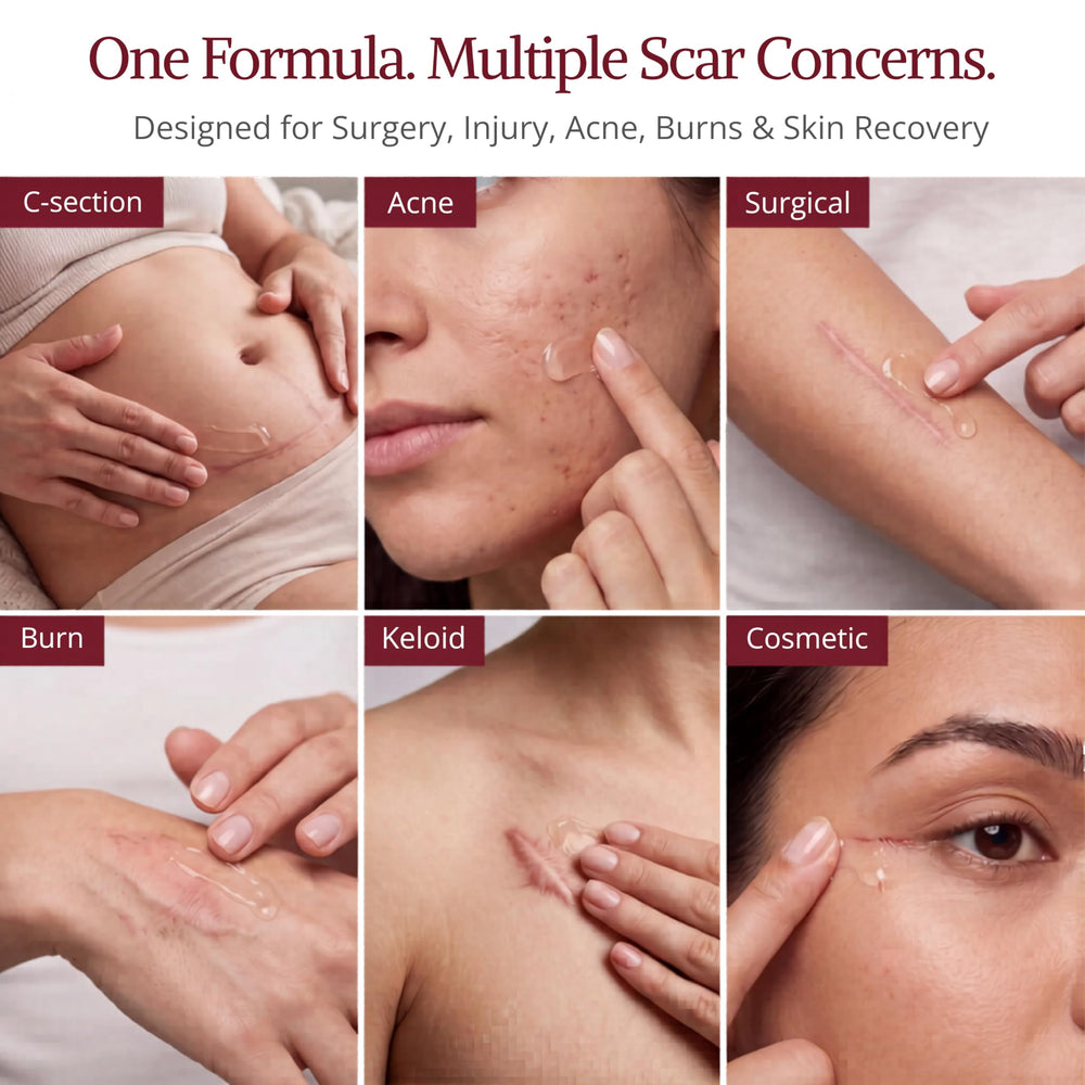 HealFast being applied to arm scar demonstrating gentle post‑surgery care