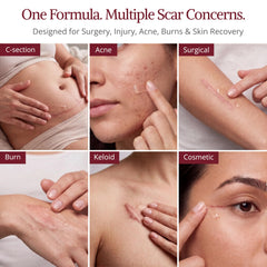 HealFast being applied to arm scar demonstrating gentle post‑surgery care