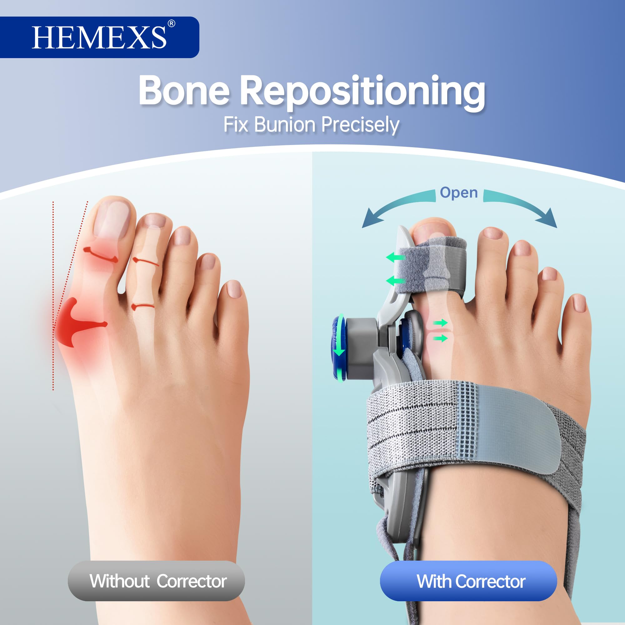 HEMEXS worn on left foot while standing showing stable everyday support