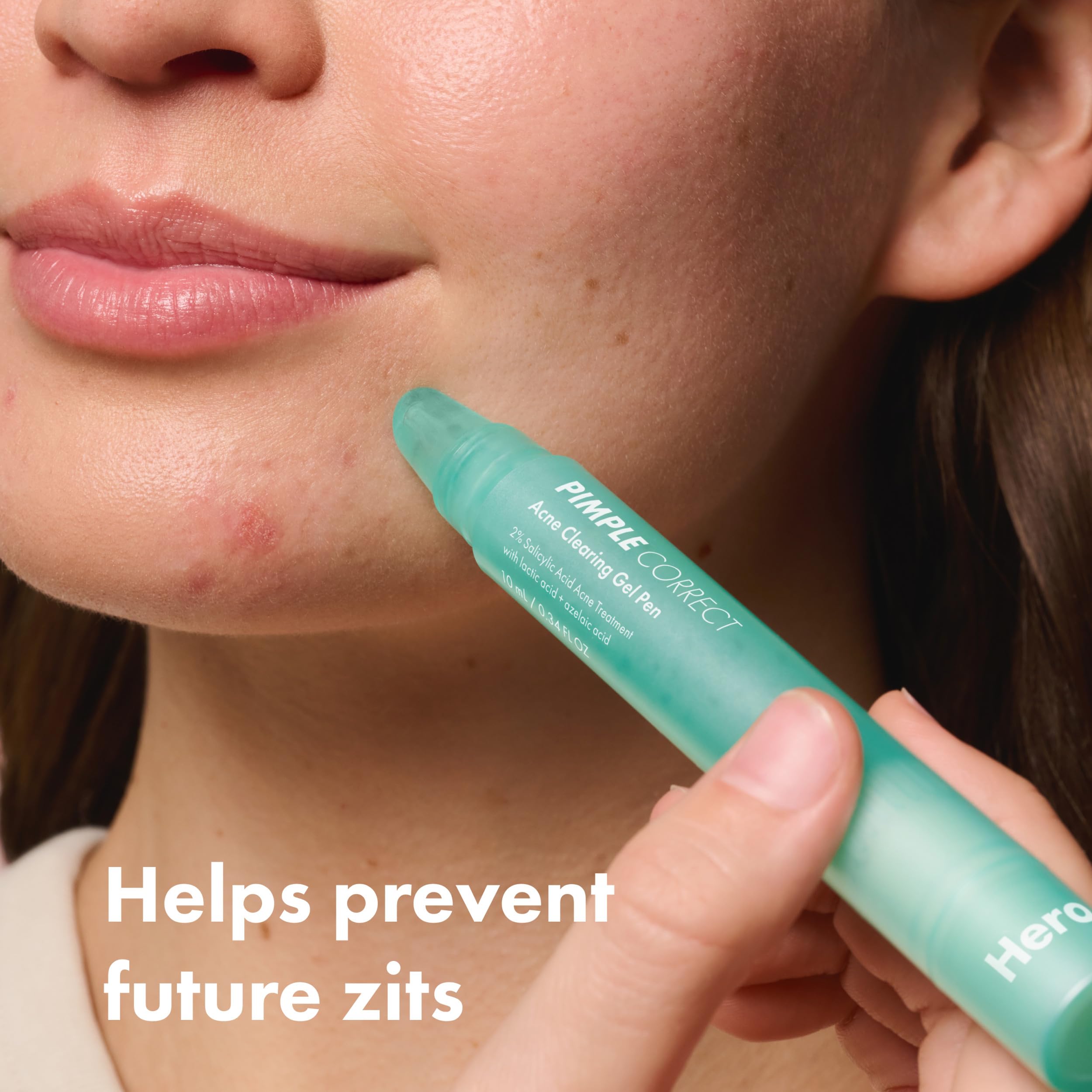 HERO COSMETICS applying gel to a blemish for targeted spot treatment