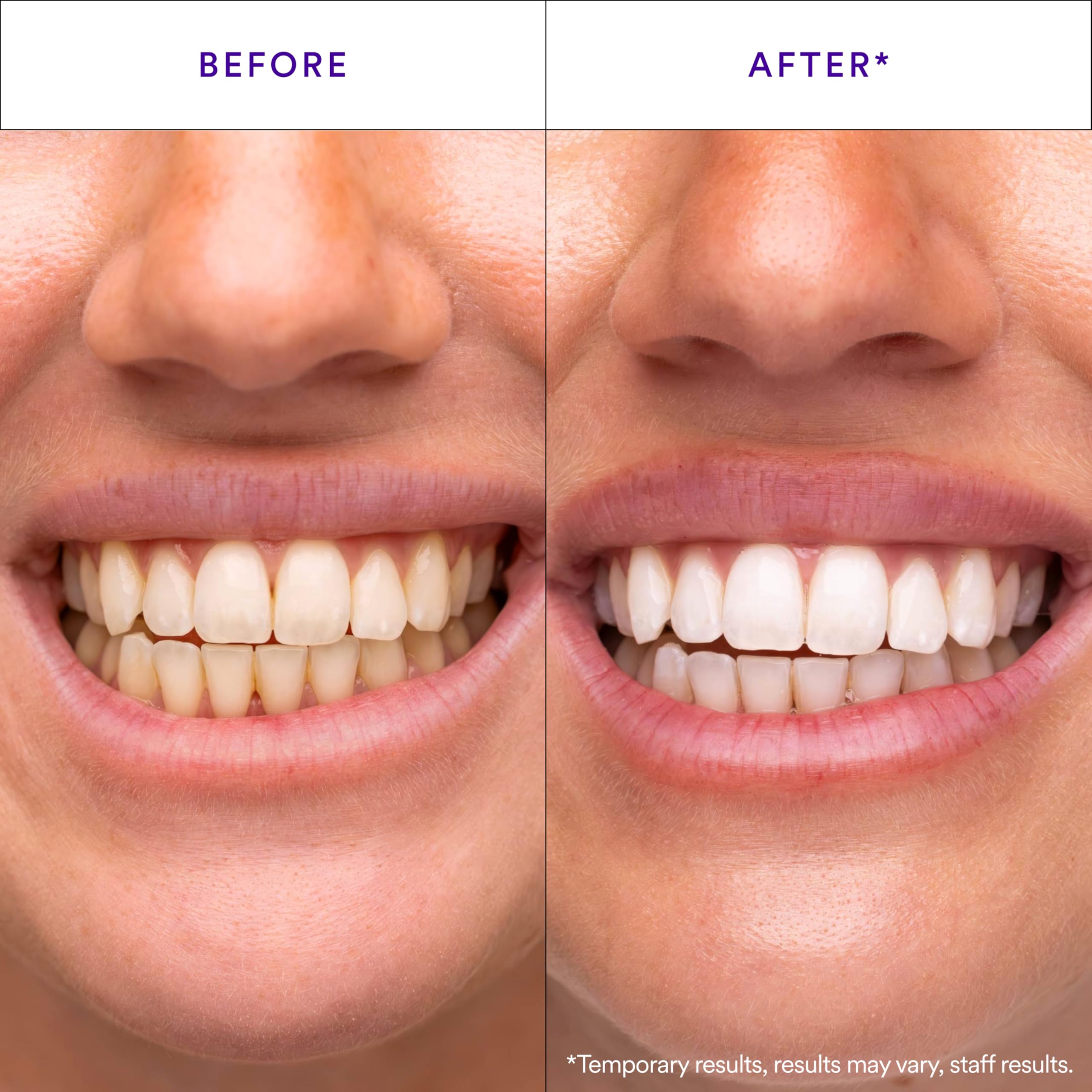 HISMILE close-up of purple strip texture highlighting secure adhesive