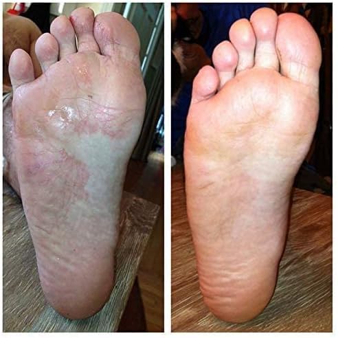Imperial Feet in athletic gear setting supporting hygiene after exercise
