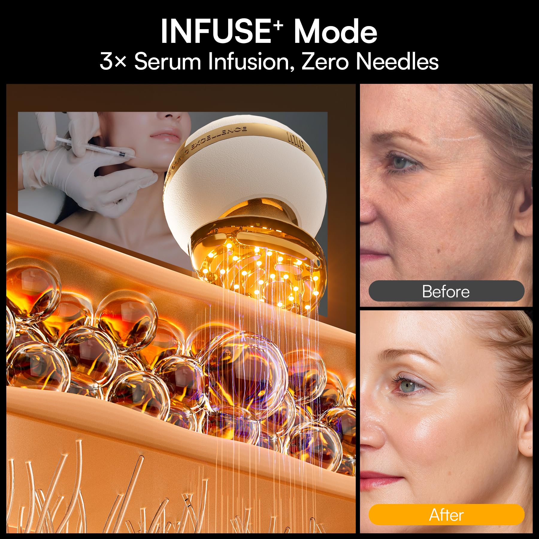 INIA SPHERA cryo cooling head illustrating instant de-puffing benefit