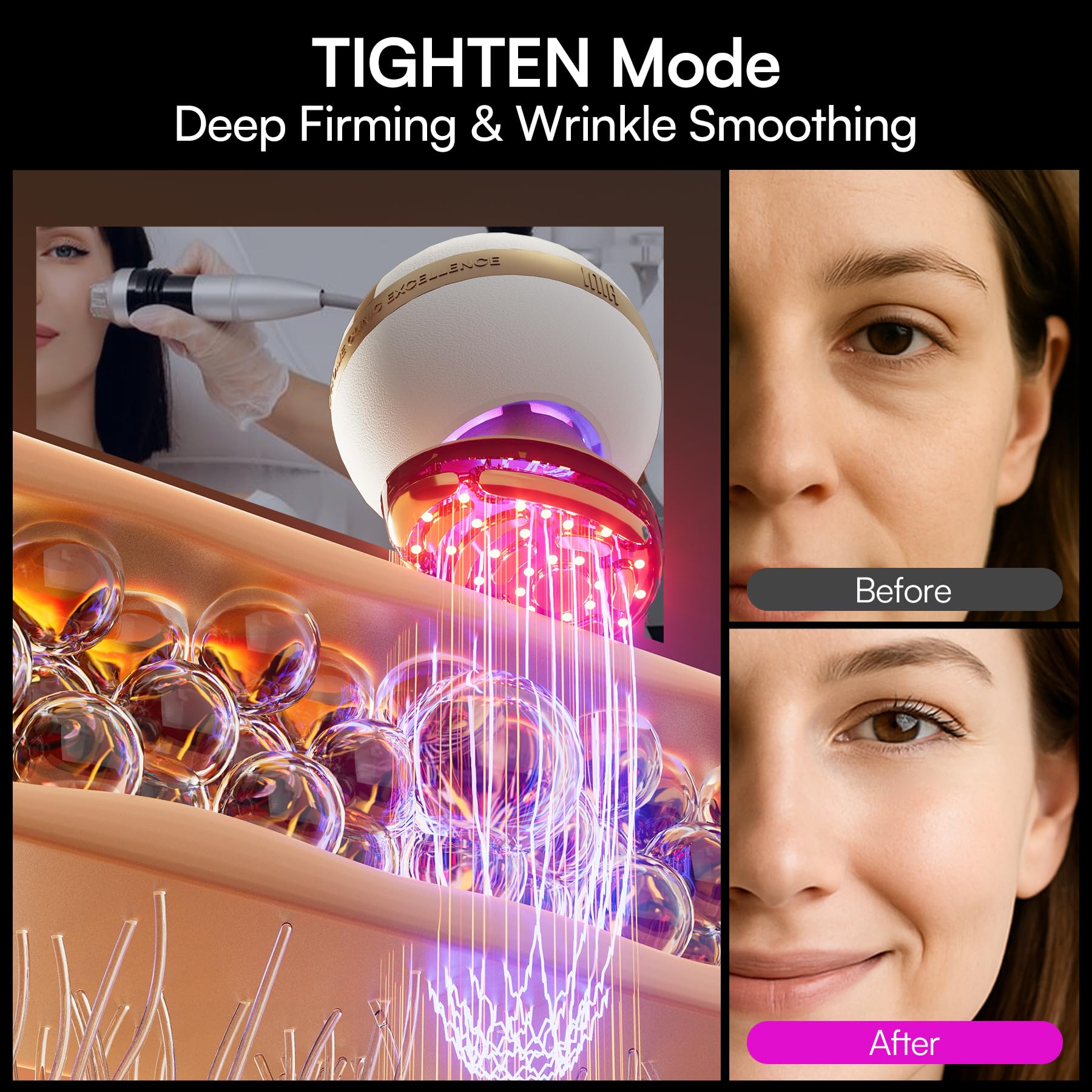 INIA SPHERA infusion mode with gel to boost serum absorption