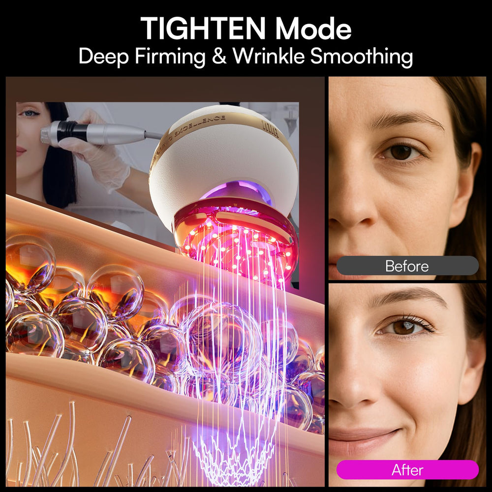 INIA SPHERA infusion mode with gel to boost serum absorption