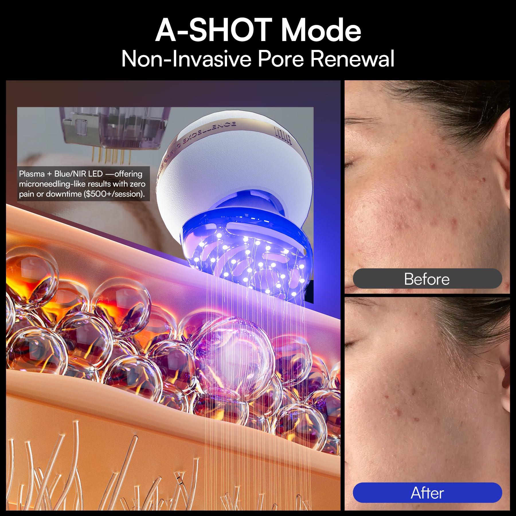 INIA SPHERA red LED active on skin demonstrating radiance support