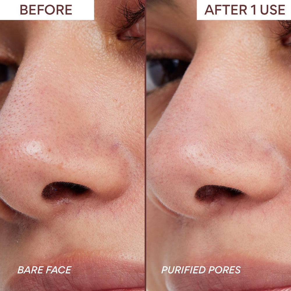 innisfree application on model t-zone showing targeted pore-clearing effect