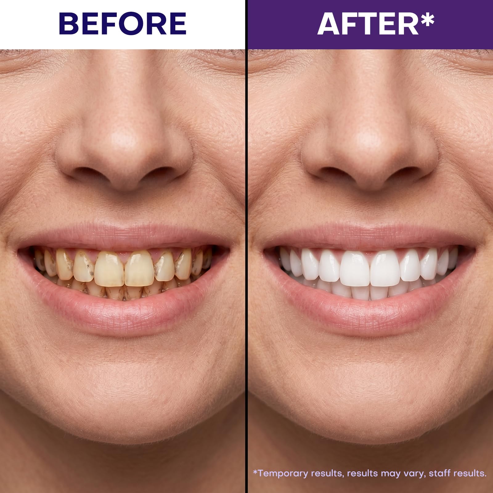 JEEDOVIA strip applied on teeth demonstrating easy use
