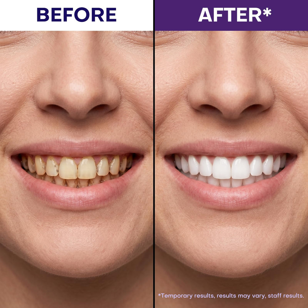 JEEDOVIA strip applied on teeth demonstrating easy use