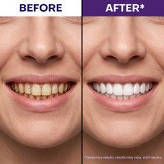 JEEDOVIA strip applied on teeth demonstrating easy use