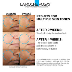 La Roche-Posay dropper with serum texture demonstrating lightweight absorption benefit