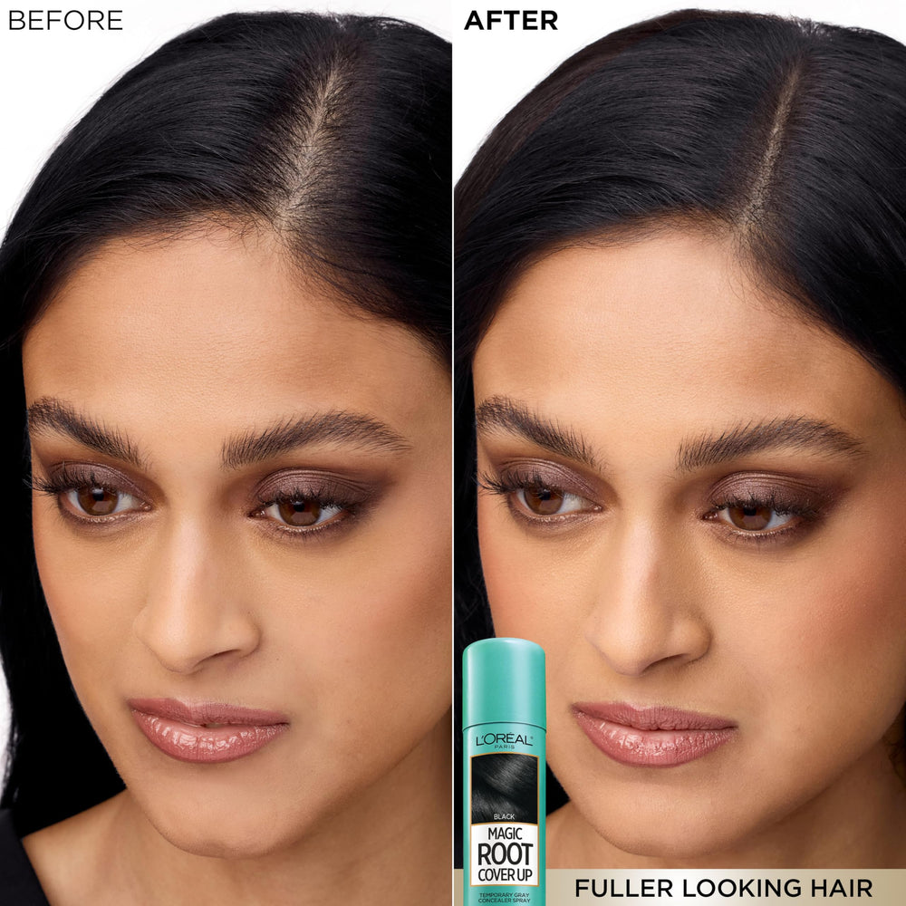 L'Oreal Paris close-up on hairline demonstrating concealed grays