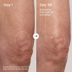 MAËLYS before and after arm comparison showing improved texture and firmer look