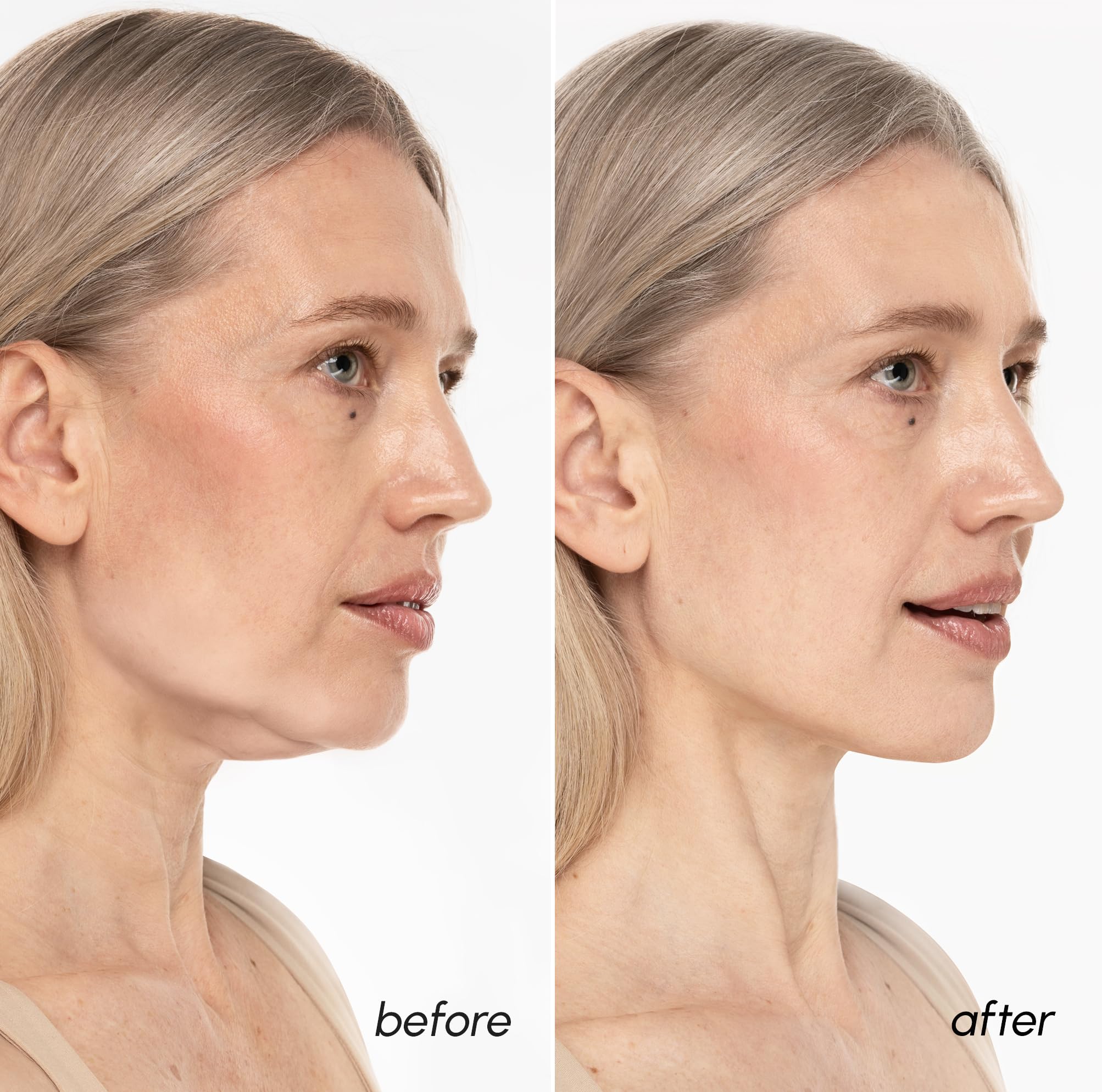 MAREE hydrogel texture and thickness close-up conveying comfortable adhesion and serum delivery