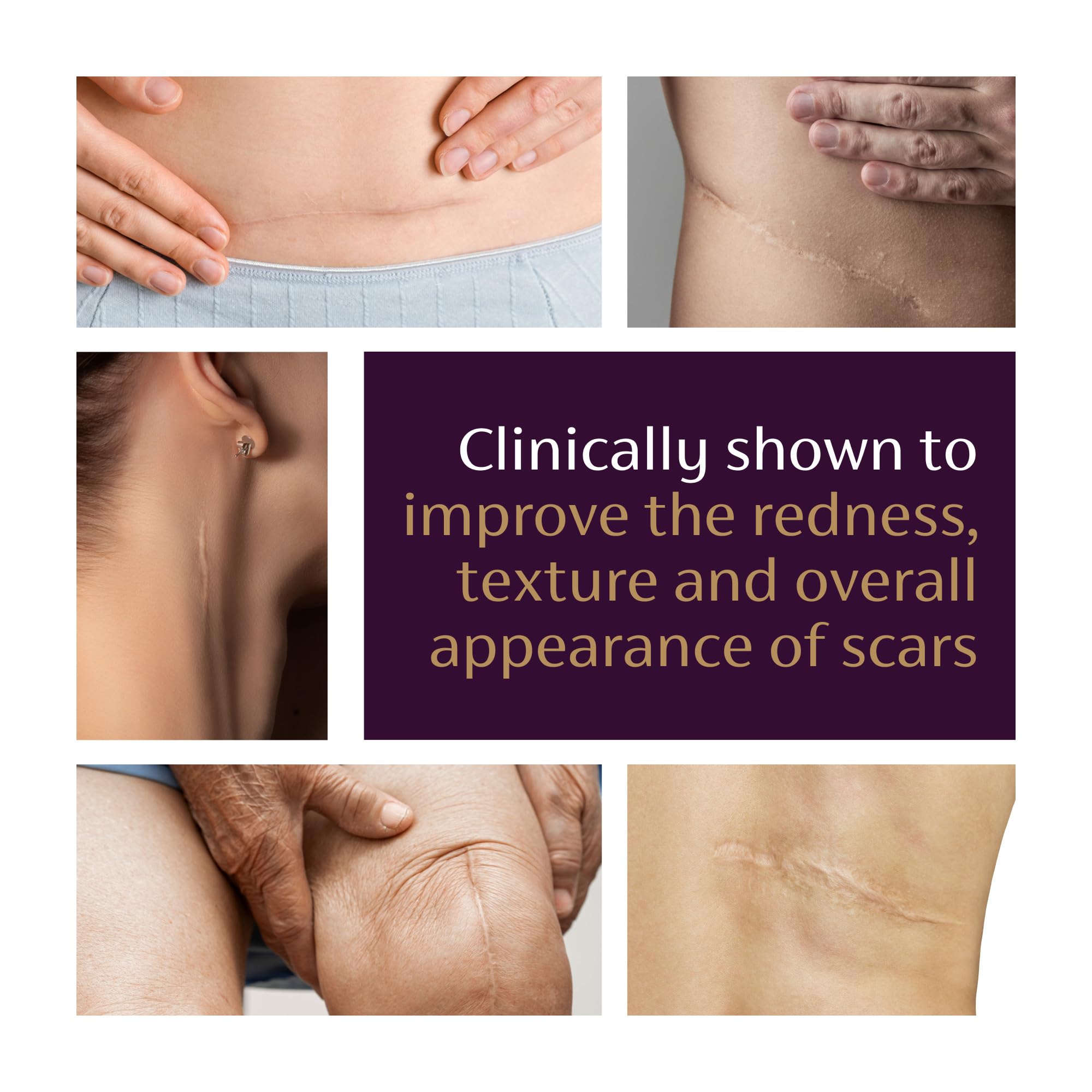 Applying Mederma gel to skin with fingertip for targeted improvement