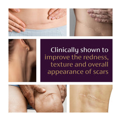 Applying Mederma gel to skin with fingertip for targeted improvement