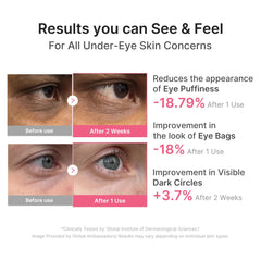 medicube single hydrogel eye patch close-up showing thin cooling gel