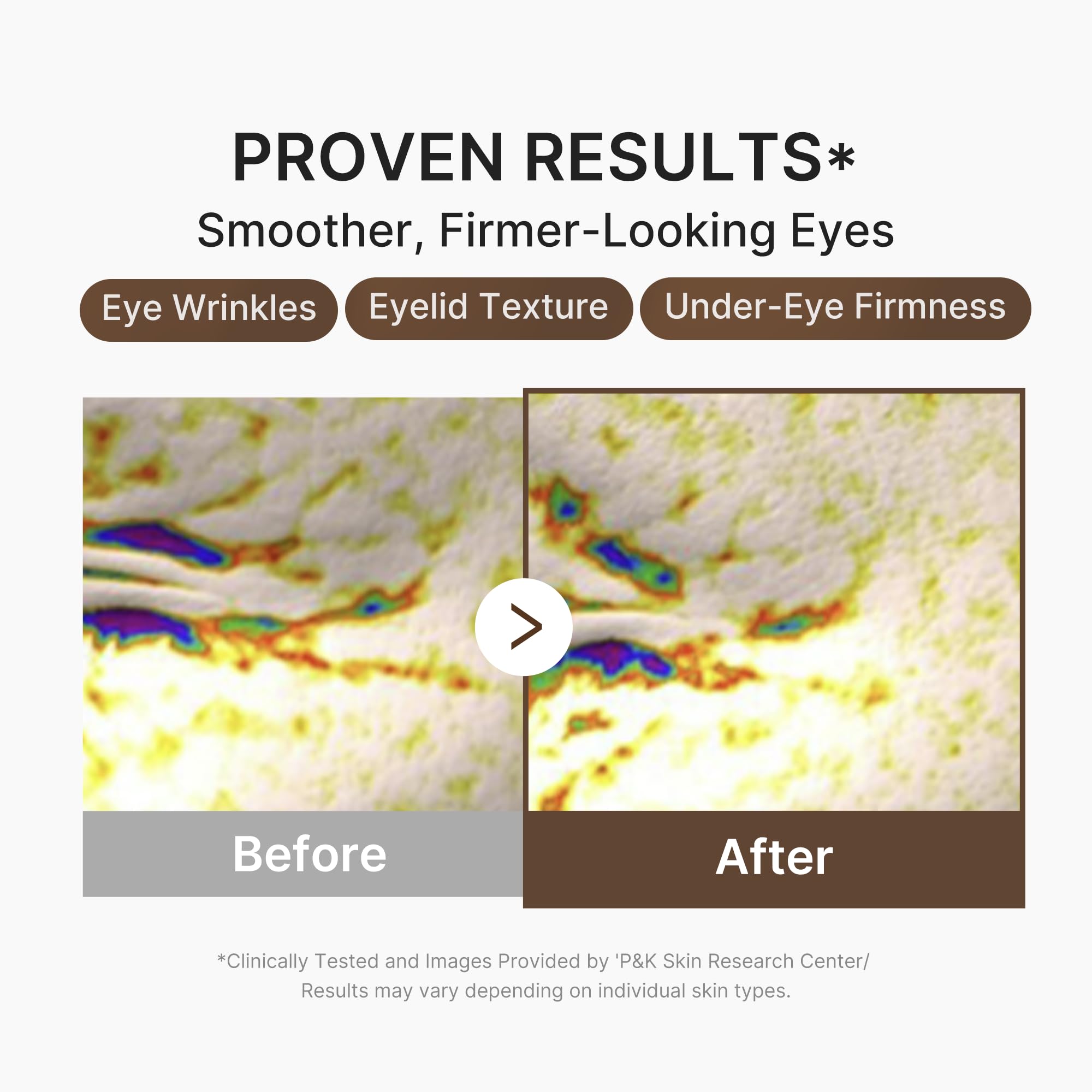 medicube serum applied under eye demonstrating gentle patting and visible hydration benefit