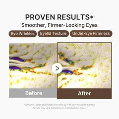 medicube serum applied under eye demonstrating gentle patting and visible hydration benefit
