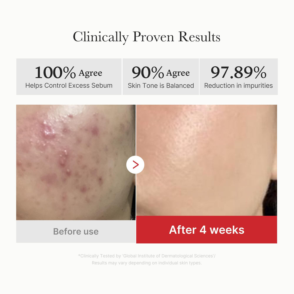 medicube pad in hand being applied for quick acne control