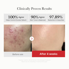 medicube pad in hand being applied for quick acne control