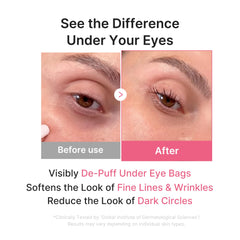 medicube patch applied under eye demonstrating de-puffing effect