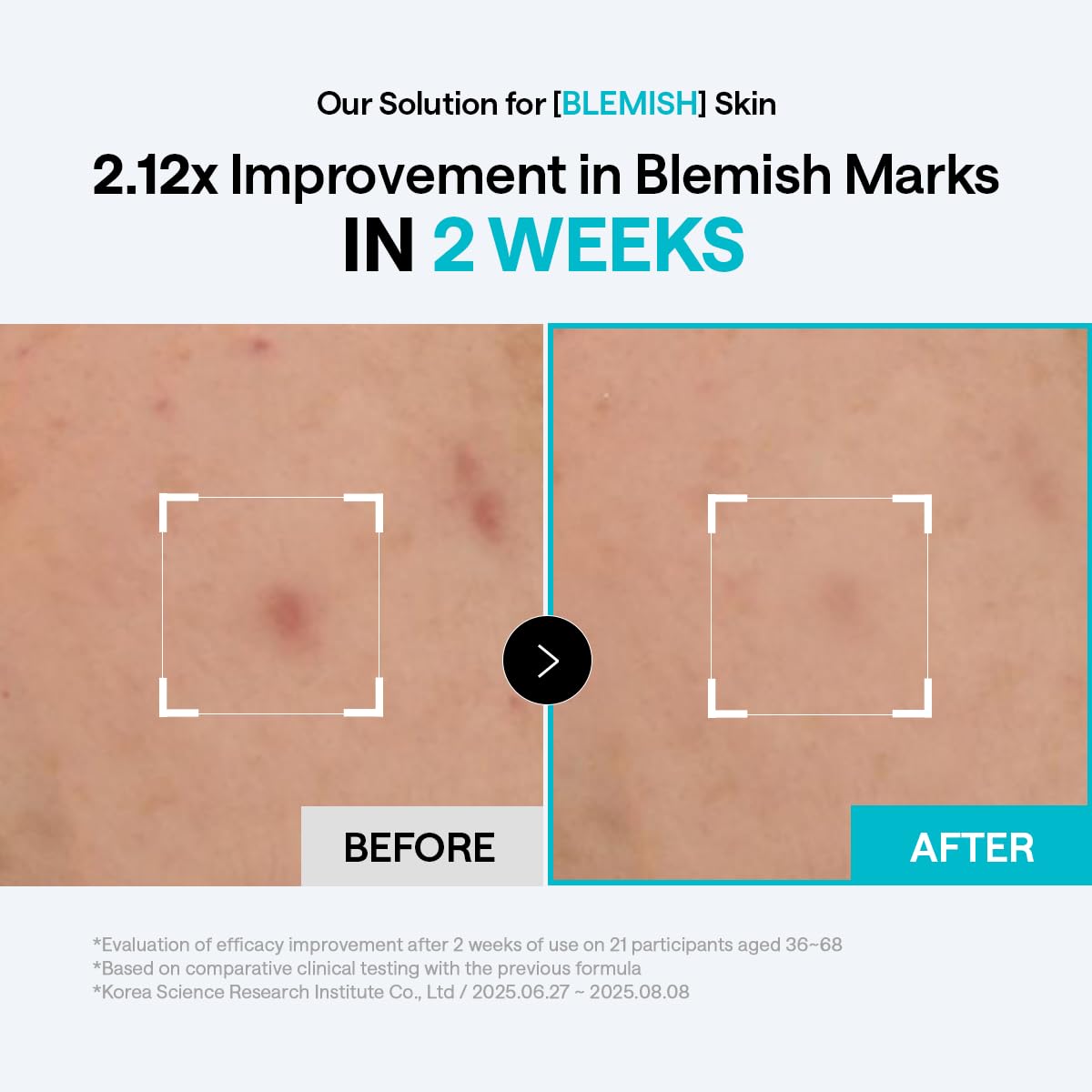 MEDIHEAL pad being applied to face demonstrating fast removal of oil and impurities benefit