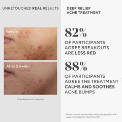 Murad Deep Relief label detail with active ingredient list and calming agents
