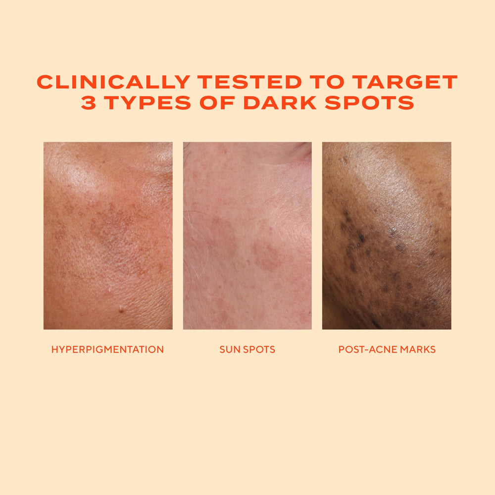 Murad applying serum to cheek for targeted spot treatment benefit