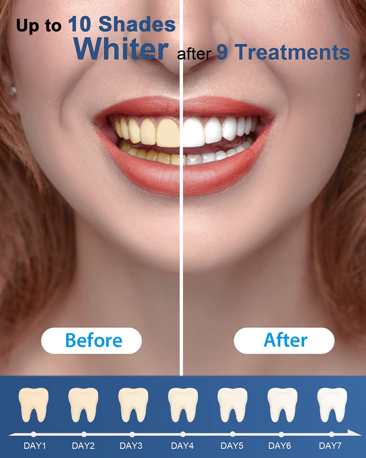 MySmile pens staged on bathroom counter showing at-home whitening routine