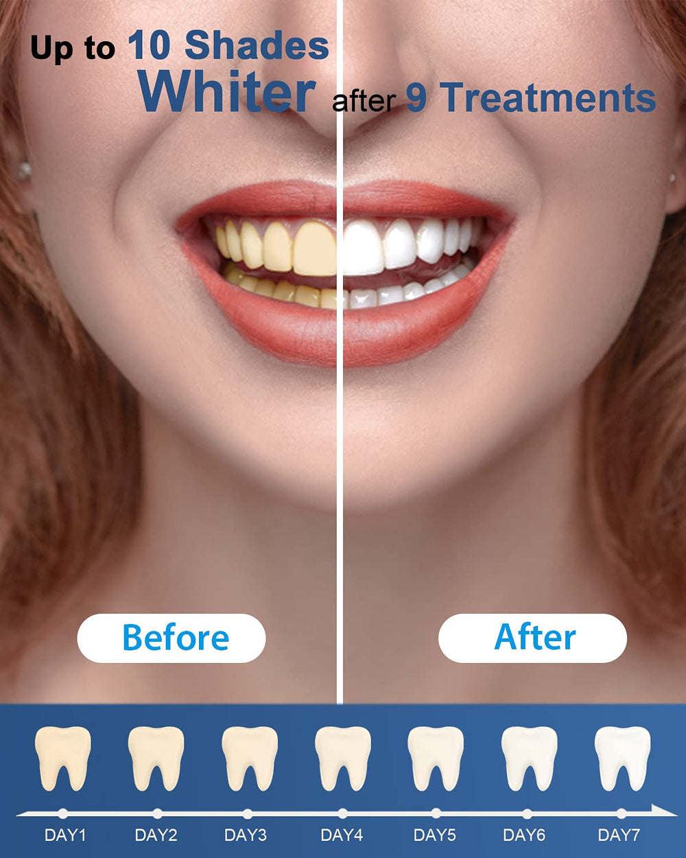 MySmile pens staged on bathroom counter showing at-home whitening routine