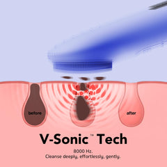 NågraCoola silicone bristle close-up highlighting soft texture for gentle exfoliation