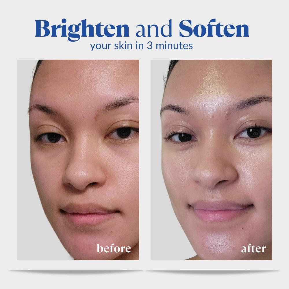Natural Aqua Gel Cure applied on cheek demonstrating smoothening benefit