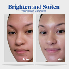 Natural Aqua Gel Cure applied on cheek demonstrating smoothening benefit