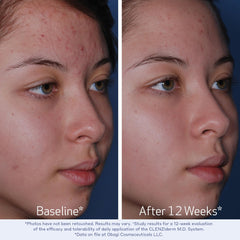 Obagi Medical foam texture on hand demonstrating gentle effective cleanse