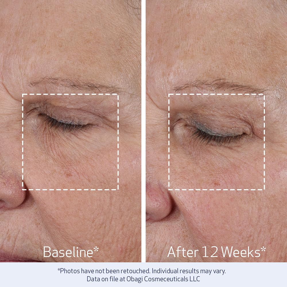 Applying Obagi ELASTIderm to neck to tighten skin and improve elasticity in delicate areas