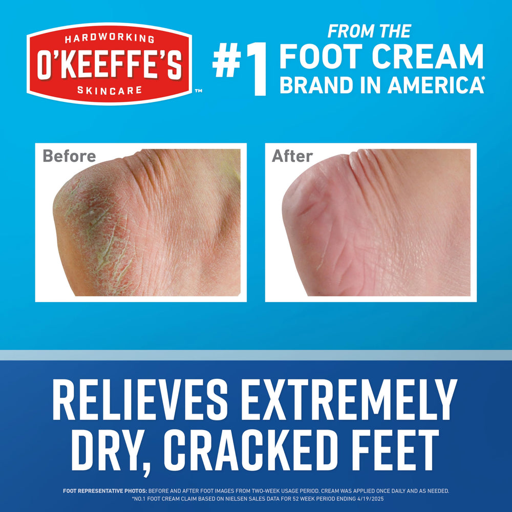 O'Keeffe's cream being applied to heel to soothe cracks and lock moisture