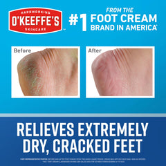 O'Keeffe's cream being applied to heel to soothe cracks and lock moisture