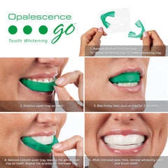 opalescence tray close-up highlighting prefilled gel and fit