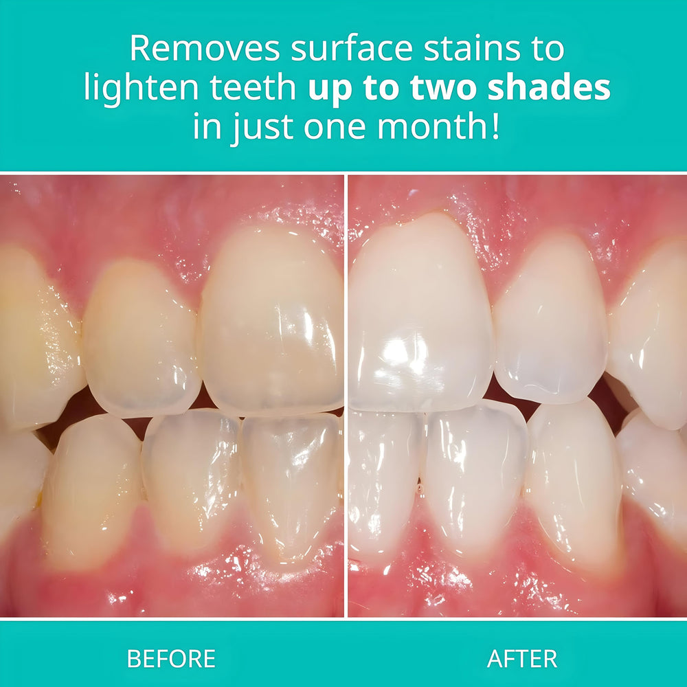 Opalescence toothpaste texture on brush highlighting gentle silica stain removal