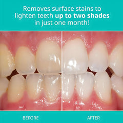 Opalescence toothpaste texture on brush highlighting gentle silica stain removal