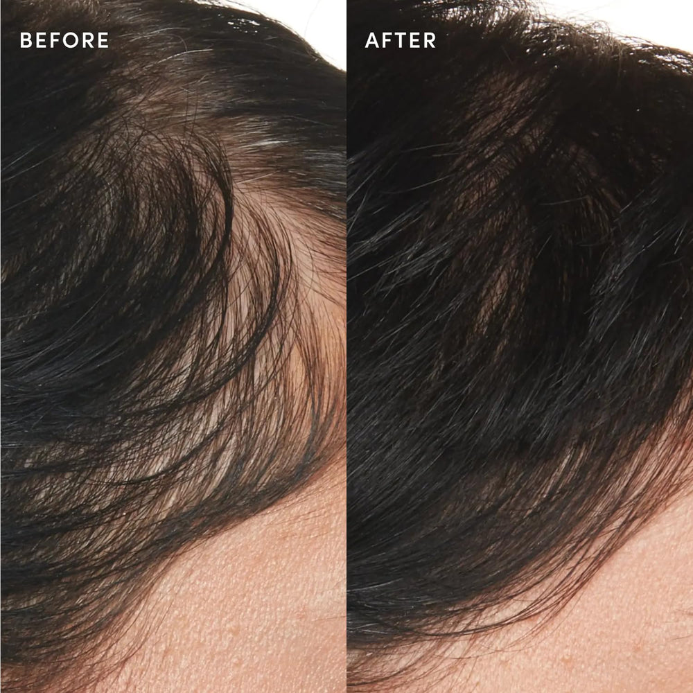 OUAI applying serum to scalp demonstrating targeted relief and ease benefit