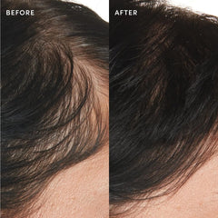 OUAI applying serum to scalp demonstrating targeted relief and ease benefit