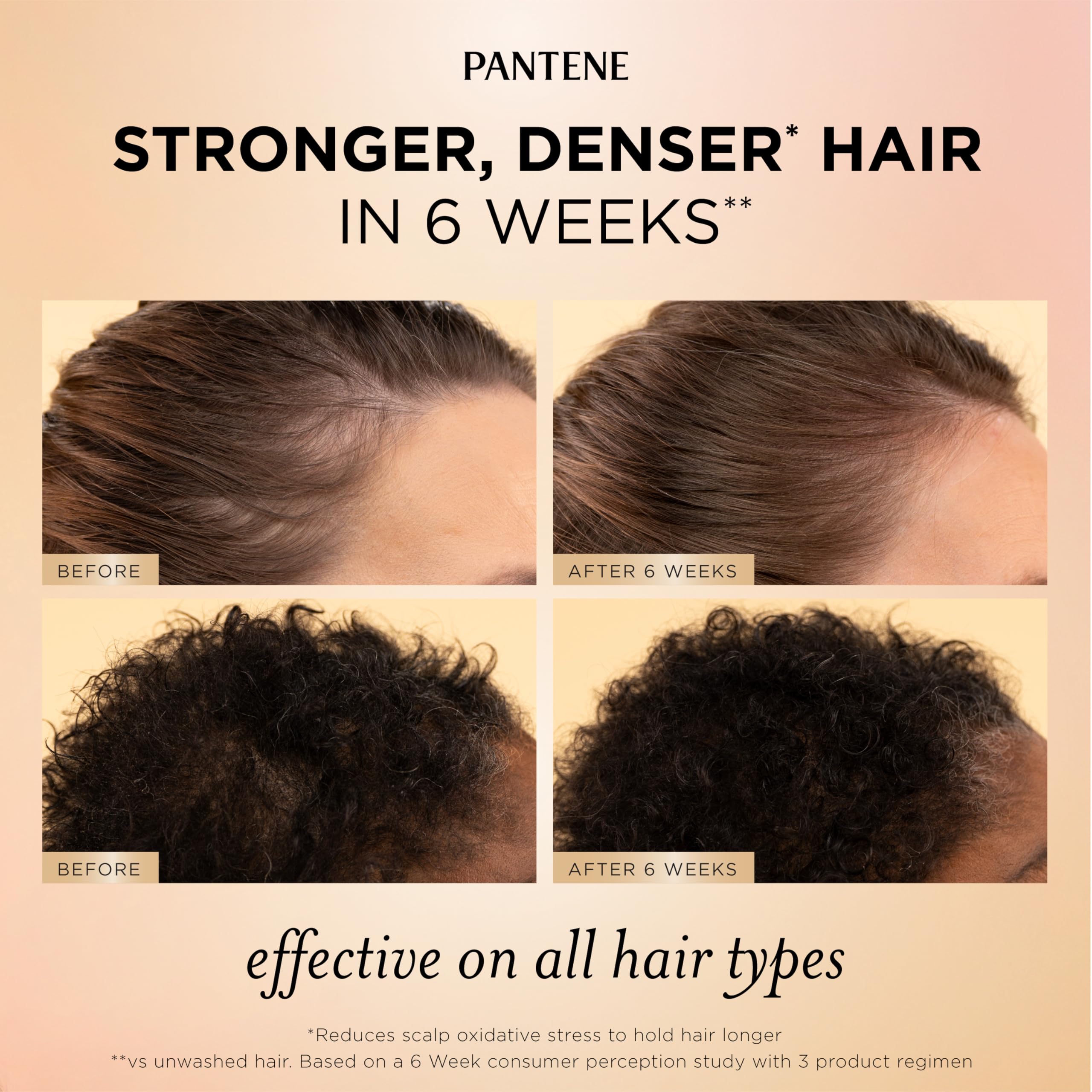 Pantene scalp and root serum dropper detail emphasizing precise, non-greasy application